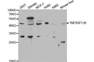 Western blot analysis of extracts of various cell lines, using TNFRSF11B antibody. (Osteoprotegerin 抗体)