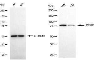 anti-phosphofructokinase, Platelet (PFKP) antibody