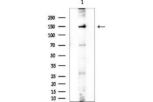 Western blot analysis of lysates from Rat brain, using DHX8 Antibody at 1/1000 dilution.