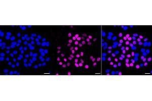 anti-Chromatin Licensing and DNA Replication Factor 1 (CDT1) antibody