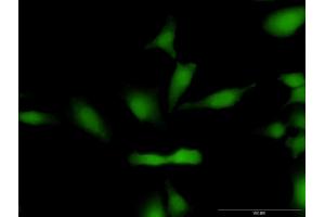 Immunofluorescence of purified MaxPab antibody to CCND1 on HeLa cell.