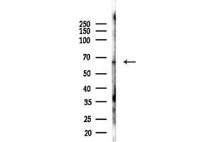 Western blot analysis of lysates from LoVo cells(heat-shock,45 min treatment), using TNR11 Antibody at 1/1000 dilution.