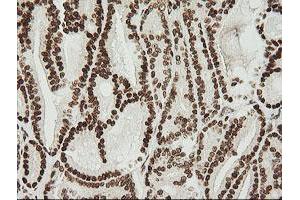 Image no. 6 for anti-Zinc Finger and SCAN Domain Containing 18 (ZSCAN18) antibody (ABIN1501857)