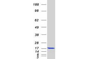 Western Blotting (WB) image for Inhibitor of DNA Binding 2 (Id2) protein (Myc-DYKDDDDK Tag) (ABIN2723228)