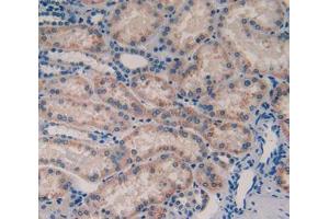 Used in DAB staining on fromalin fixed paraffin- embedded tissue (TOR3A 抗体  (AA 125-374))