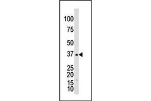 The anti-GALK1 Pab (ABIN391114 and ABIN2841244) is used in Western blot to detect GALK1 in Y79 cell lysate. (GALK1 抗体  (C-Term))