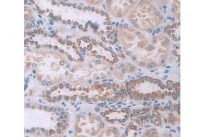Used in DAB staining on fromalin fixed paraffin- embedded Kidney tissue (GAA 抗体  (AA 70-225))
