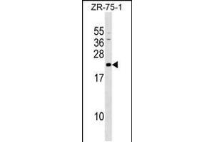 Western blot analysis in ZR-75-1 cell line lysates (35ug/lane). (GRPEL1 抗体  (AA 116-142))