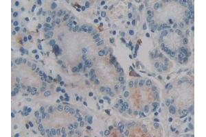 Immunohistochemistry (IHC) image for anti-Interleukin 12 alpha (IL12A) (AA 23-219) antibody (ABIN7428245)