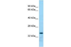 WB Suggested Anti-Rab17 Antibody Titration: 1. (RAB17 抗体  (Middle Region))