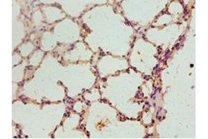 Immunohistochemistry of paraffin-embedded mouse lung tissue using ABIN7152800 at dilution of 1:100 (FGF2 抗体  (AA 143-288))