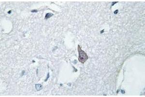 Image no. 2 for anti-Opioid Receptor, mu 1 (OPRM1) antibody (ABIN317766) (Mu Opioid Receptor 1 抗体)