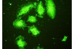 Detection of TLR5 in A549 cells using Polyclonal Antibody to Toll Like Receptor 5 (TLR5) (TLR5 抗体  (AA 46-205))