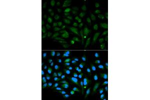 Immunofluorescence analysis of MCF-7 cells using DCN antibody (ABIN5970829). (Decorin 抗体)