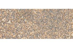 Immunohistochemistry of paraffin-embedded Human tonsil tissue using PDAP1 Polyclonal Antibody at dilution of 1:50(x200) (PDAP1 抗体)