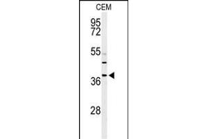 Western blot analysis of RNASEH2B Antibody (Center) (ABIN650970 and ABIN2840016) in CEM cell line lysates (35 μg/lane). (RNASEH2B 抗体  (AA 130-157))