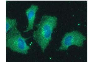 ICC/IF analysis of PPP1R14A in A549 cells line, stained with DAPI (Blue) for nucleus staining and monoclonal anti-human PPP1R14A antibody (1:100) with goat anti-mouse IgG-Alexa fluor 488 conjugate (Green). (CPI-17 抗体)