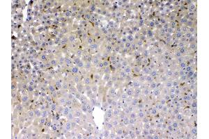 PSAT1 was detected in paraffin-embedded sections of mouse liver tissues using rabbit anti- PSAT1 Antigen Affinity purified polyclonal antibody (Catalog # ) at 1 ?