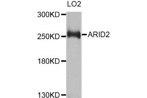 Western blot analysis of extracts of LO2 cells, using ARID2 antibody. (ARID2 抗体)