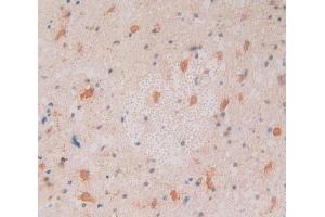 Used in DAB staining on fromalin fixed paraffin- embedded glioma tissue (CNTNAP4 抗体  (AA 706-886))
