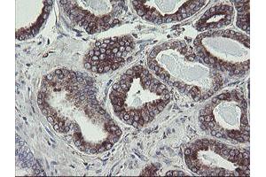 Image no. 6 for anti-Tumor Protein D52-Like 3 (TPD52L3) antibody (ABIN1501475)