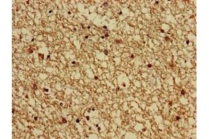 Immunohistochemistry of paraffin-embedded human brain tissue using ABIN7154707 at dilution of 1:100 (GNAS 抗体  (AA 1-394))