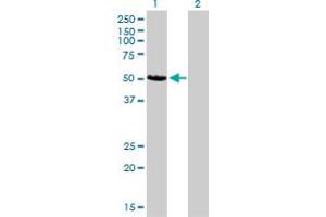 Western Blot analysis of CAMK2D expression in transfected 293T cell line by CAMK2D monoclonal antibody (M02), clone 1A8. (CAMK2D 抗体  (AA 301-410))