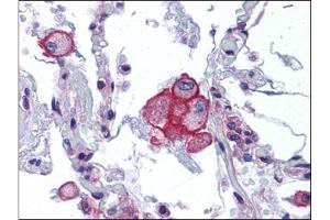 Immunohistochemistry (Paraffin-embedded Sections) (IHC (p)) image for anti-Transient Receptor Potential Cation Channel, Subfamily V, Member 2 (TRPV2) (Ser157) antibody (ABIN615540)