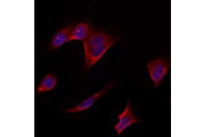 ABIN6264846 and ABIN6273312 staining Hela by IF/ICC. (RPS14 抗体  (Internal Region))