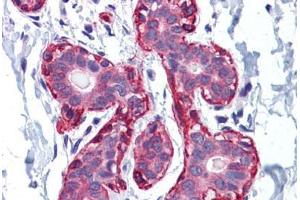 Human Breast: Formalin-Fixed, Paraffin-Embedded (FFPE) (Actin 抗体  (AA 1-129))