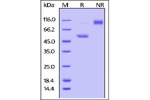 SDS-PAGE (SDS) image for CD40 Ligand (CD40LG) (AA 115-260) (Active) protein (Fc Tag) (ABIN4949167)