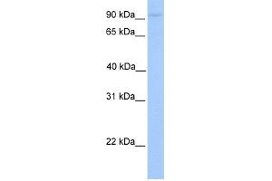 WB Suggested Anti-AGBL5 Antibody Titration: 0. (AGBL5 抗体  (C-Term))