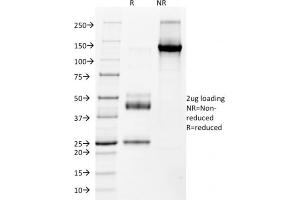 SDS-PAGE Analysis Purified NKX2. (Nkx2-2 抗体  (AA 1-119))