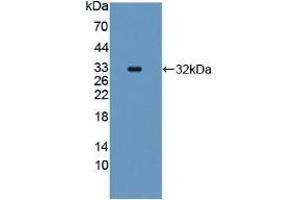 Detection of Recombinant CASP11, Human using Polyclonal Antibody to Protein SCAF11 (SCAF11) (SCAF11 抗体  (AA 944-1148))