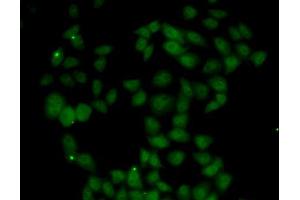 Immunofluorescence analysis of U2OS cells using FGF14 antibody (ABIN5973959). (FGF14 抗体)
