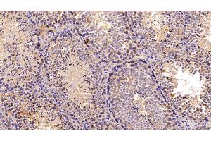 Detection of C3 Convertase in Mouse Testis Tissue using Polyclonal Antibody to Complement C3 Convertase (C3 Convertase) (Complement C3 Convertase 抗体)