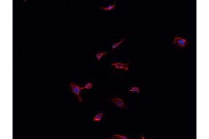 ABIN6268891 staining LOVO cells by IF/ICC. (FAP 抗体  (Internal Region))