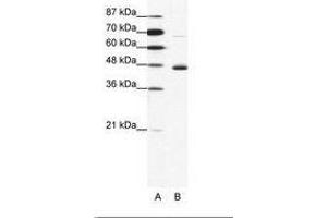 Image no. 1 for anti-Neuronal Differentiation 1 (NEUROD1) (N-Term) antibody (ABIN202333) (NEUROD1 抗体  (N-Term))