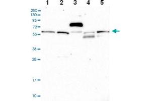 Western blot analysis of Lane 1: RT-4 Lane 2: U-251 MG Lane 3: Human Plasma Lane 4: Liver Lane 5: Tonsil with C15orf44 polyclonal antibody ( Cat # PAB28001 ) at 1:100 - 1:250 dilution. (VWA9 抗体)