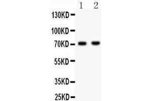 Anti- NUMB Picoband antibody, Western blotting All lanes: Anti NUMB  at 0. (NUMB 抗体  (N-Term))