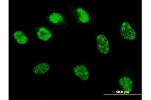 Immunofluorescence (IF) image for anti-MutS Homolog 6 (E. Coli) (MSH6) (AA 931-1030) antibody (ABIN561171)