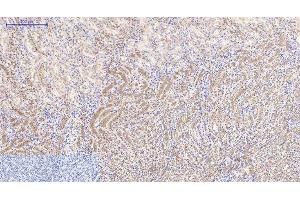 Immunohistochemistry of paraffin-embedded Mouse kidney tissue using Catenin beta Monoclonal Antibody at dilution of 1:200. (beta Catenin 抗体)