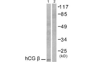 Western Blotting (WB) image for anti-HCG beta (C-Term) antibody (ABIN1848592) (HCG beta 抗体  (C-Term))