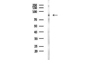 Western blot analysis of lysates from MDA-MB-231 cells(heat-shock,45 min treatment), using EZH2 Antibody at 1/1000 dilution.