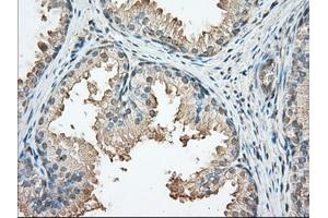 Immunohistochemistry (IHC) image for anti-Protein Kinase, CAMP-Dependent, Regulatory, Type II, alpha (PRKAR2A) antibody (ABIN2729600)