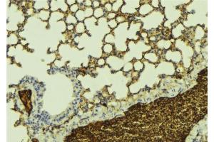 Immunohistochemistry (IHC) image for anti-Potassium Voltage-Gated Channel, KQT-Like Subfamily, Member 1 (KCNQ1) (C-Term) antibody (ABIN6262757)