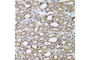 Immunohistochemistry of paraffin-embedded mouse kidney using D antibody (ABIN7266712) at dilution of 1:100 (40x lens). (DAPK3 抗体  (AA 1-100))