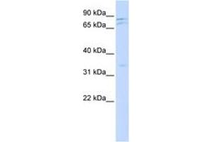 Image no. 1 for anti-NIMA (Never In Mitosis Gene A)-Related Kinase 11 (NEK11) (AA 504-553) antibody (ABIN6743500) (NEK11 抗体  (AA 504-553))