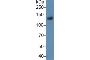 Detection of LIFR in Rat Placenta lysate using Polyclonal Antibody to Leukemia Inhibitory Factor Receptor (LIFR) (LIFR 抗体  (AA 642-791))