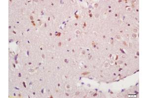 Formalin-fixed and paraffin embedded rat brain labeled with Anti-phospho-MAPKAPK5(Thr182) Polyclonal Antibody, Unconjugated (ABIN710546) at 1:200, followed by conjugation to the secondary antibody and DAB staining (MAPKAP Kinase 5 抗体  (pThr182))